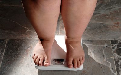 Morbid Obesity: Causes, Treatment And More- HealthifyMe